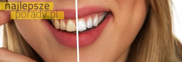 Proszek do wybielania zębów - hit czy kit?